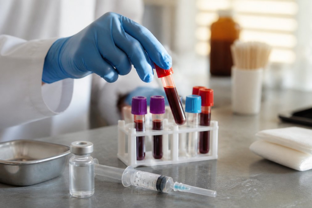 Lab-Based Testosterone Therapy in California: A 2026 Guide