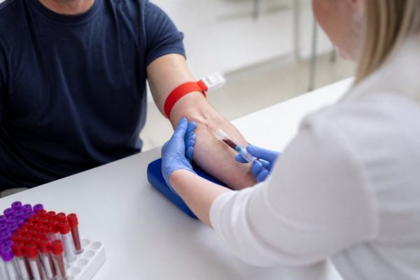 Labcorp Blood Test for TRT: A Complete Guide