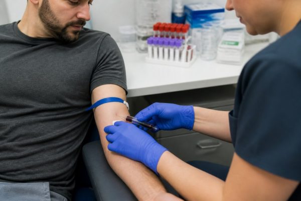 LabCorp Blood Test for TRT: A Step-by-Step Guide