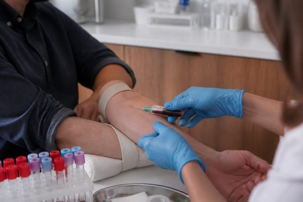 How to Prepare for Testosterone Blood Work
