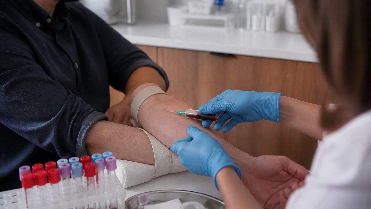 How to Prepare for Testosterone Blood Work